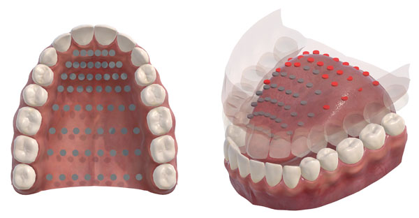 how-3D-electropalatography-works.jpg